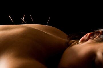 Acupuncture is a 3000 year old modality that uses hair thin needles to stimulate the body’s natural healing mechanism.